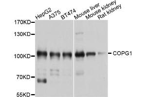 Western blot analysis of extracts of various cell lines, using COPG1 antibody (ABIN4903348) at 1:1000 dilution. (COPG 抗体)