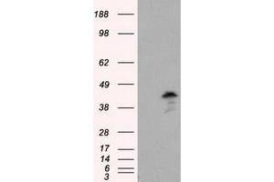 Western Blotting (WB) image for anti-Induced Myeloid Leukemia Cell Differentiation Protein Mcl-1 (MCL1) antibody (ABIN1499337) (MCL-1 抗体)