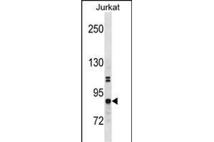 CHUK Antibody (N-term) (ABIN1881203 and ABIN2838746) western blot analysis in Jurkat cell line lysates (35 μg/lane). (IKK alpha 抗体  (N-Term))