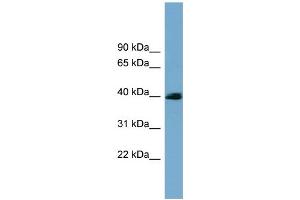 WB Suggested Anti-CXorf9 Antibody Titration: 0. (SASH3 抗体  (N-Term))