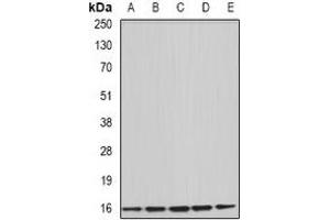 Western blot analysis of Uev1A expression in HepG2 (A), Hela (B), mouse brain (C), rat liver (D), rat spleen (E) whole cell lysates. (UBE2V1 抗体)