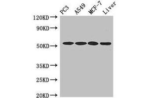Western Blot Positive WB detected in: PC-3 whole cell lysate, A549 whole cell lysate, MCF-7 whole cell lysate, , Mouse liver tissue All lanes: IRF6 antibody at 4 μg/mL Secondary Goat polyclonal to rabbit IgG at 1/50000 dilution Predicted band size: 54, 42 kDa Observed band size: 54 kDa