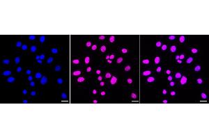 Immunocytochemical staining of HepG2 cells with PRPF4 antibody (ABIN7800056), 1:1,000). (Recombinant PRPF4 抗体)