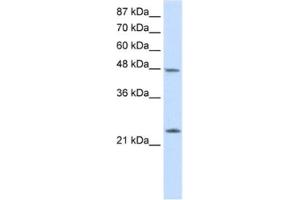 Western Blotting (WB) image for anti-Chromobox Homolog 6 (CBX6) antibody (ABIN2461846) (CBX6 抗体)