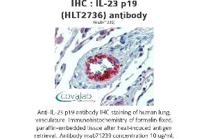 Image no. 2 for anti-Interleukin 23, alpha subunit p19 (IL23A) antibody (ABIN1724064) (IL23A 抗体)