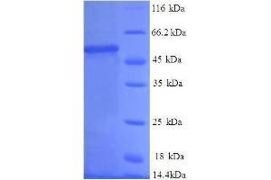 SDS-PAGE (SDS) image for Proteasome (Prosome, Macropain) Subunit, beta Type, 1 (PSMB1) (AA 29-241), (full length) protein (GST tag) (ABIN7479194)