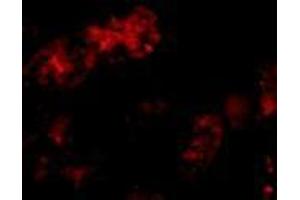 Immunofluorescence of Bmf in human kidney tissue with AP30156PU-N Bmf antibody at 10 μg/ml. (BMF 抗体  (C-Term))