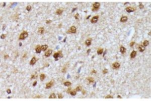 Immunohistochemistry of paraffin-embedded Rat brain using KIAA1429 Polyclonal Antibody at dilution of 1:100 (40x lens). (VIRMA/KIAA1429 抗体)