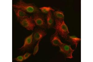 IF analysis of SNF2H/SMARCA5 and Tubulin beta using anti-SNF2H/SMARCA5 antibody (ABIN7600125) and anti-Tubulin beta antibody (ABIN7602744). (ABI2 抗体  (AA 151-400))
