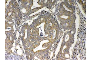 IHC analysis of MAVS using anti-MAVS antibody . (MAVS 抗体  (AA 34-96))
