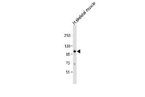 Anti-GAS2L2 Antibody (C-term) at 1:1000 dilution + human skeletal muscle lysate Lysates/proteins at 20 μg per lane. (GAS2L2 抗体  (C-Term))
