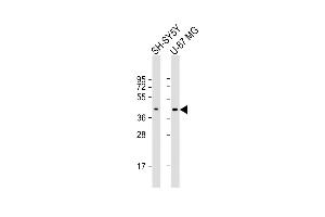 All lanes : Anti-GPR45 Antibody (Center) at 1:2000 dilution Lane 1: SH-SY5Y whole cell lysate Lane 2: U-87 MG whole cell lysate Lysates/proteins at 20 μg per lane. (GPR45 抗体  (AA 121-149))