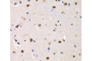 Immunohistochemistry of paraffin-embedded Rat brain using IRF2 Polyclonal Antibody at dilution of 1:200 (40x lens). (IRF2 抗体)