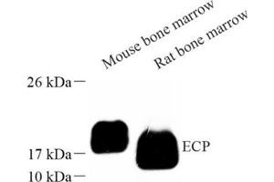 Western blot analysis of ECP (ABIN7073838) at dilution of 1: 1000 (RNASE3 抗体)
