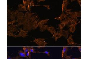 Immunofluorescence analysis of C6 cells using PDGFR beta Polyclonal Antibody at dilution of 1:100. (PDGFRB 抗体)
