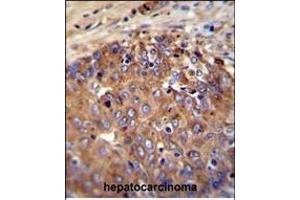 Immunohistochemistry (Paraffin-embedded Sections) (IHC (p)) image for anti-Nitric Oxide Synthase 2, Inducible (NOS2) (AA 830-860) antibody (ABIN655717)
