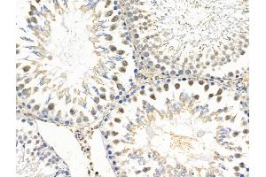 ABIN6257905 and ABIN6274686 at 1/100 staining Rat testis tissue by IHC-P. (Exonuclease 1 抗体  (N-Term))
