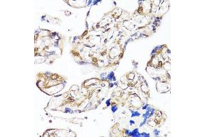 Immunohistochemistry (Paraffin-embedded Sections) (IHC (p)) image for anti-Yes-Associated Protein 1 (YAP1) antibody (ABIN1683302)