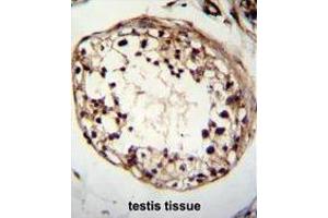 TSPYL6 Antibody (Center) immunohistochemistry analysis in formalin fixed and paraffin embedded human testis tissue followed by peroxidase conjugation of the secondary antibody and DAB staining. (TSPY-Like 6 抗体  (Middle Region))