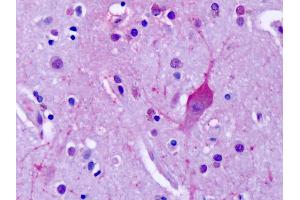 Anti-MGLUR4 antibody IHC of human brain, cortex, neurons. (Metabotropic Glutamate Receptor 4 抗体  (C-Term))