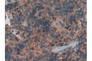 Immunohistochemistry (IHC) image for anti-Haptoglobin (HP) (AA 104-346) antibody (ABIN7443863)