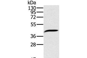 Western Blot analysis of Hela cell using PDSS2 Polyclonal Antibody at dilution of 1:200 (PDSS2 抗体)