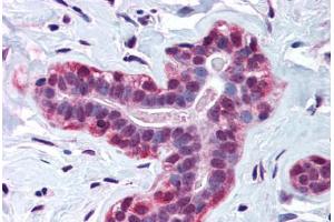 Human Breast (formalin-fixed, paraffin-embedded) stained with WRNIP1 antibody ABIN214570 at 3 ug/ml followed by biotinylated goat anti-rabbit IgG secondary antibody ABIN481713, alkaline phosphatase-streptavidin and chromogen. (WRNIP1 抗体  (AA 67-116))