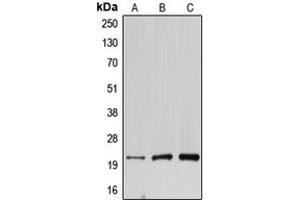 Western blot analysis of DNAL1 expression in HEK293T (A), mouse testis (B), rat kidney (C) whole cell lysates. (DNAL1 抗体  (Center))