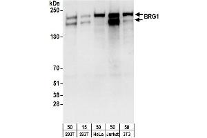 Western Blotting (WB) image for anti-SWI/SNF Related, Matrix Associated, Actin Dependent Regulator of Chromatin, Subfamily A, Member 4 (SMARCA4) (AA 50-100) antibody (ABIN7454978)