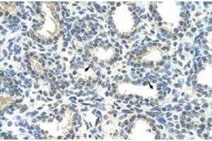 Immunohistochemical staining (Formalin-fixed paraffin-embedded sections) of human lung with HOXC9 polyclonal antibody  at 4-8 ug/mL working concentration. (HOXC9 抗体  (Internal Region))