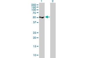 Western Blot analysis of SRPX expression in transfected 293T cell line by SRPX MaxPab polyclonal antibody. (SRPX 抗体  (AA 1-464))