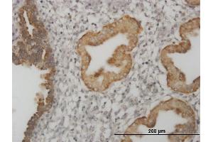 Immunoperoxidase of monoclonal antibody to MSI1 on formalin-fixed paraffin-embedded human endometrium. (MSI1 抗体  (AA 190-273))