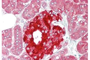 Rabbit Anti-PHGDH antibody Catalog Number: ARP54801 Formalin Fixed Paraffin Embedded Tissue: Human Pancreas Primary antibody Concentration: 1:100 Secondary Antibody: Donkey anti-Rabbit-Cy3 Secondary Antibody Concentration: 1:200 Magnification: 20x Exposure Time: 0. (PHGDH 抗体  (Middle Region))