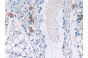 Immunohistochemistry (IHC) image for anti-Glucosidase, Alpha, Acid (GAA) (AA 755-953) antibody (ABIN7439087)