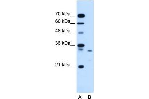 WB Suggested Anti-SDCBP Antibody Titration:  1. (SDCBP 抗体  (Middle Region))