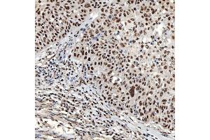 IHC analysis of SNRNP40 using anti-SNRNP40 antibody (ABIN7601719). (SNRNP40 抗体  (AA 43-357))