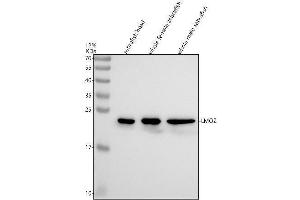Western blot analysis of LMO2 using anti-LMO2 antibody (AZQ9PTJ3-1).