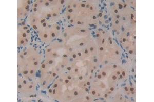 Used in DAB staining on fromalin fixed paraffin- embedded kidney tissue (TOPBP1 抗体  (AA 1-250))