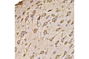 Immunohistochemistry of paraffin-embedded mouse brain using RPS14 antibody (ABIN5974066) at dilution of 1/100 (40x lens). (RPS14 抗体)