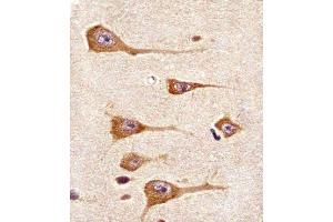 Paraformaldehyde-fixed, paraffin embedded human brain tissue, Antigen retrieval by boiling in sodium citrate buffer (pH6. (DDR1 抗体)