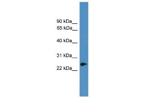 WB Suggested Anti-ZNF313 Antibody Titration:  0. (RNF114 抗体  (C-Term))