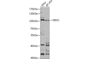 Western blot analysis of extracts of various cell lines, using ZBED1 Antibody (ABIN6132791, ABIN6150363, ABIN6150364 and ABIN6222539) at 1:1000 dilution. (ZBED1 抗体  (AA 1-280))