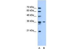 Western Blotting (WB) image for anti-Solute Carrier Family 35 (UDP-N-Acetylglucosamine (UDP-GlcNAc) Transporter), Member A3 (SLC35A3) antibody (ABIN2462748) (SLC35A3 抗体)