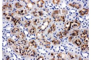IHC-P: AQP1 antibody testing of rat kidney tissue (Aquaporin 1 抗体  (C-Term))