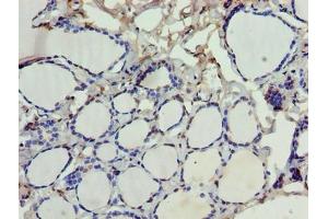 Immunohistochemistry of paraffin-embedded human thyroid tissue using ABIN7168881 at dilution of 1:100 (SDSL 抗体  (AA 39-169))