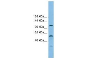 Image no. 1 for anti-CTF18, Chromosome Transmission Fidelity Factor 18 Homolog (CHTF18) (AA 791-840) antibody (ABIN6745170) (CTF18 抗体  (AA 791-840))
