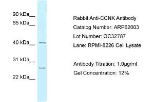 Western Blotting (WB) image for anti-Cyclin K (CCNK) (Middle Region) antibody (ABIN2788983) (Cyclin K 抗体  (Middle Region))