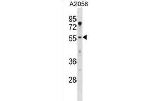 Western Blotting (WB) image for anti-Alveolar Soft Part Sarcoma Chromosome Region, Candidate 1 (ASPSCR1) antibody (ABIN2998788) (ASPSCR1 抗体)