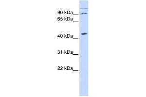 WB Suggested Anti-ZFX Antibody Titration:  0. (ZFX 抗体  (Middle Region))