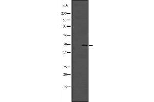 Western blot analysis of SOX4 expression in Hela cell lysate,The lane on the left is treated with the antigen-specific peptide. (SOX4 抗体  (C-Term))